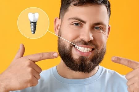 Mini Dental Implants