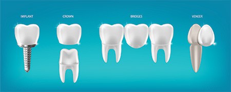 Dental Crowns