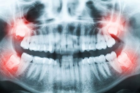 Dentist consulting with patient