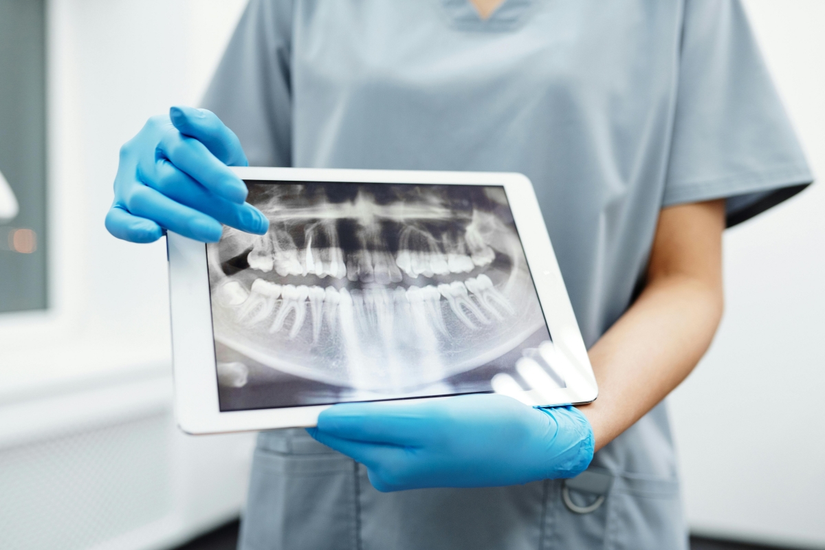 Restorative Dentistry Example