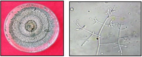 Macroscopic and Microscopic view of Trichoderma spp.