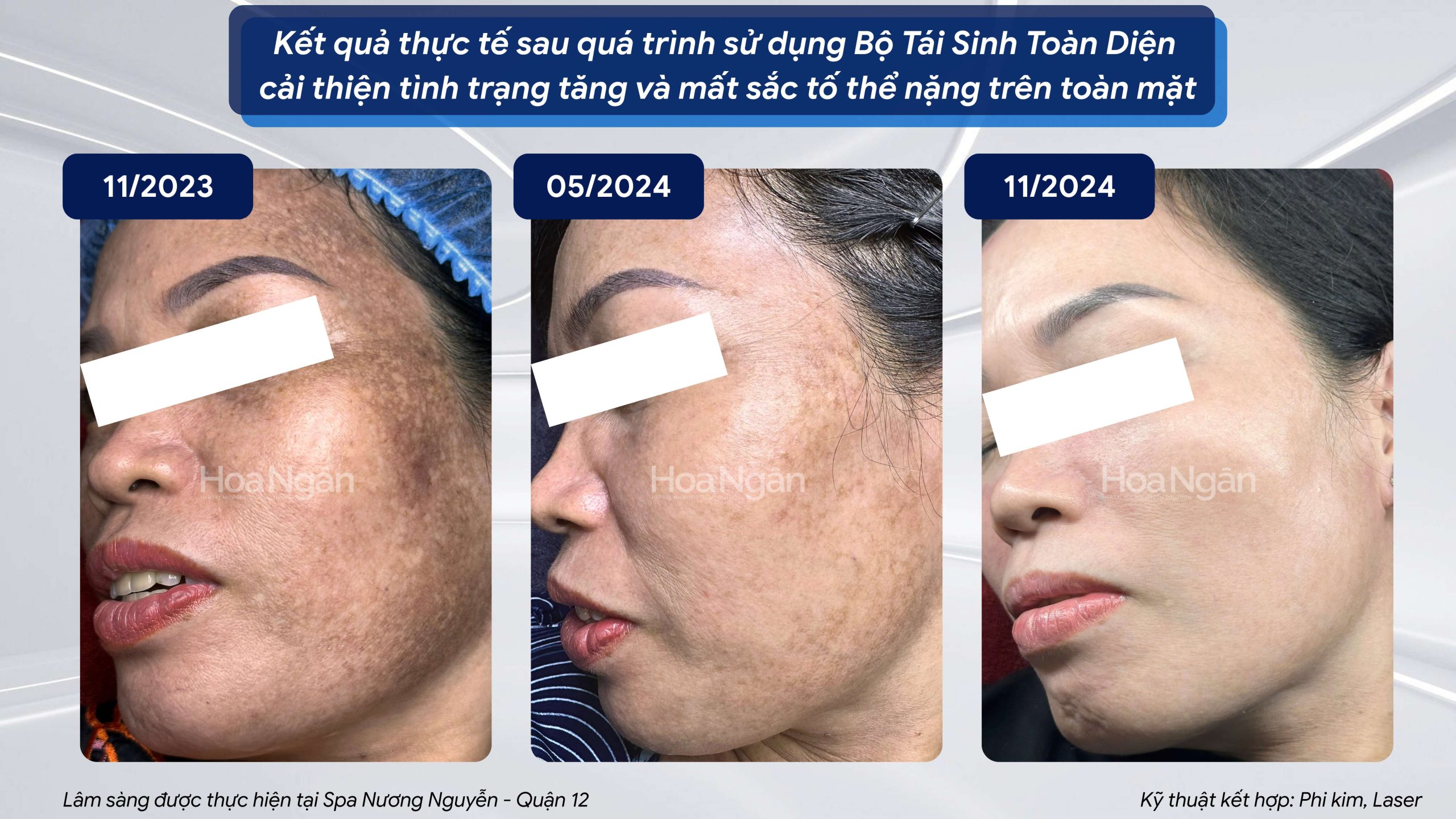 COMBO 1:
TRẮNG SÁNG, CĂNG BÓNG, CẢI THIỆN CÁC DẤU HIỆU LÃO HÓA 10