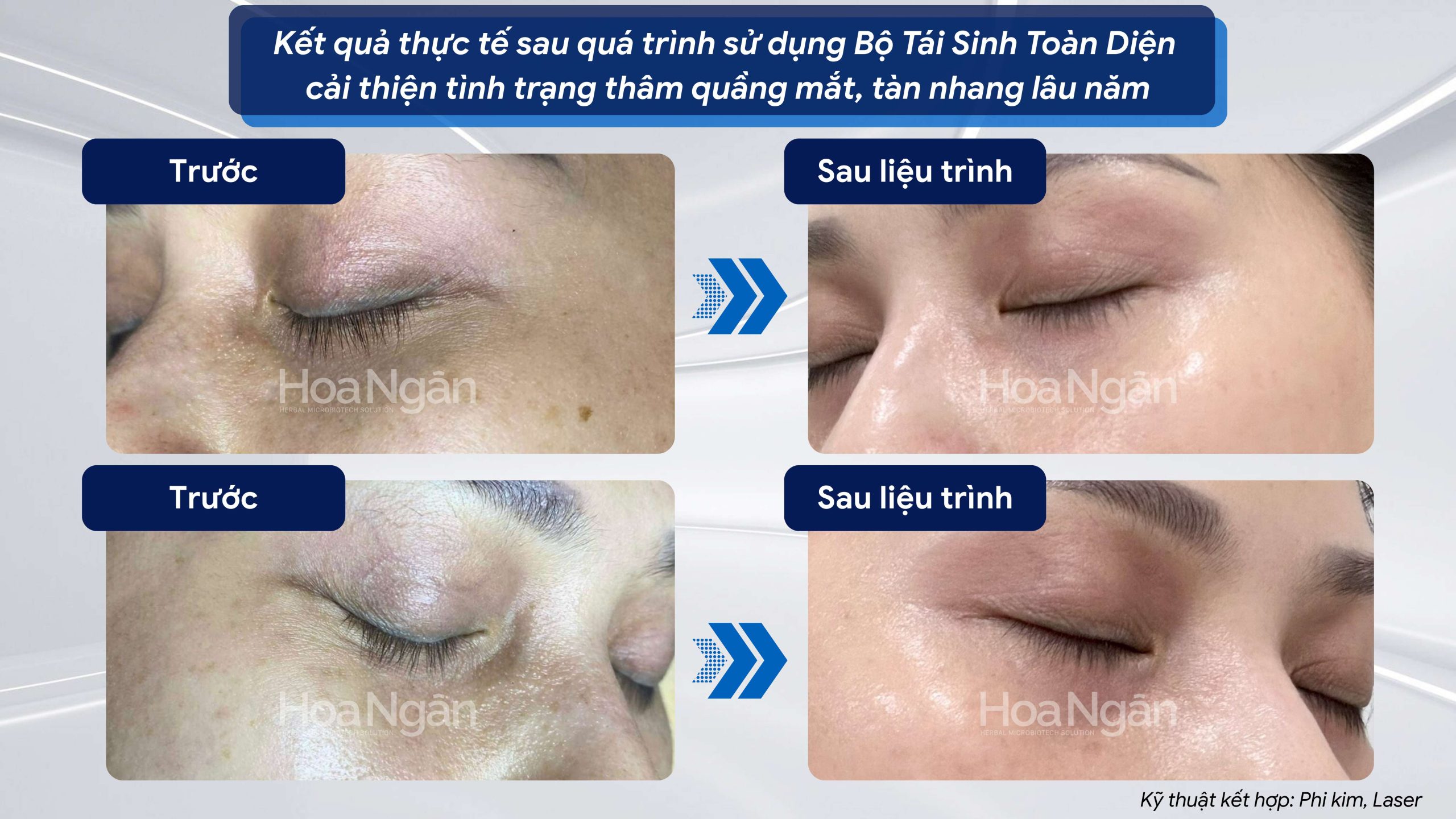 COMBO 3:
CHĂM SÓC DA TOÀN DIỆN 10