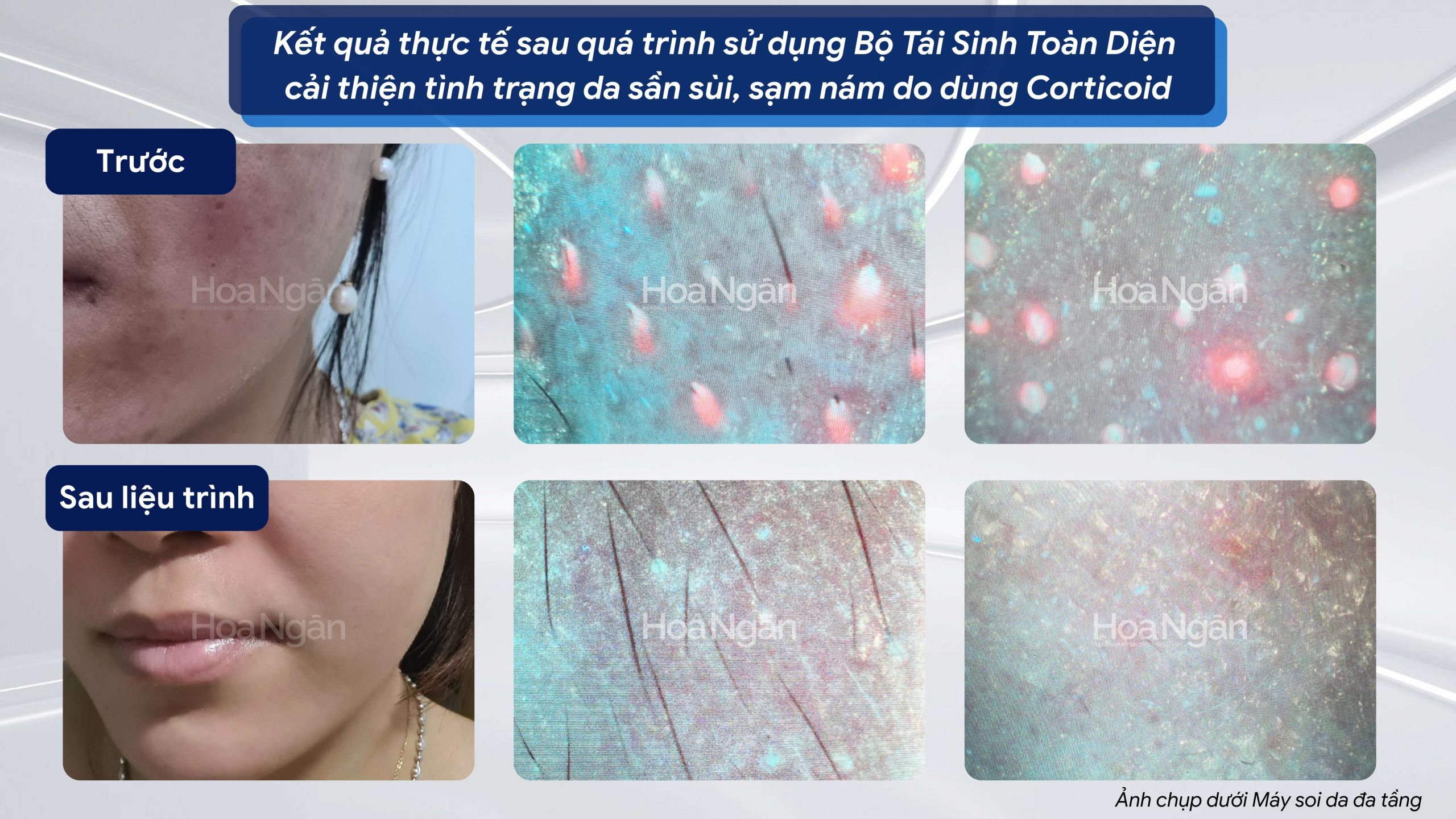 COMBO 3:
CHĂM SÓC DA TOÀN DIỆN 5
