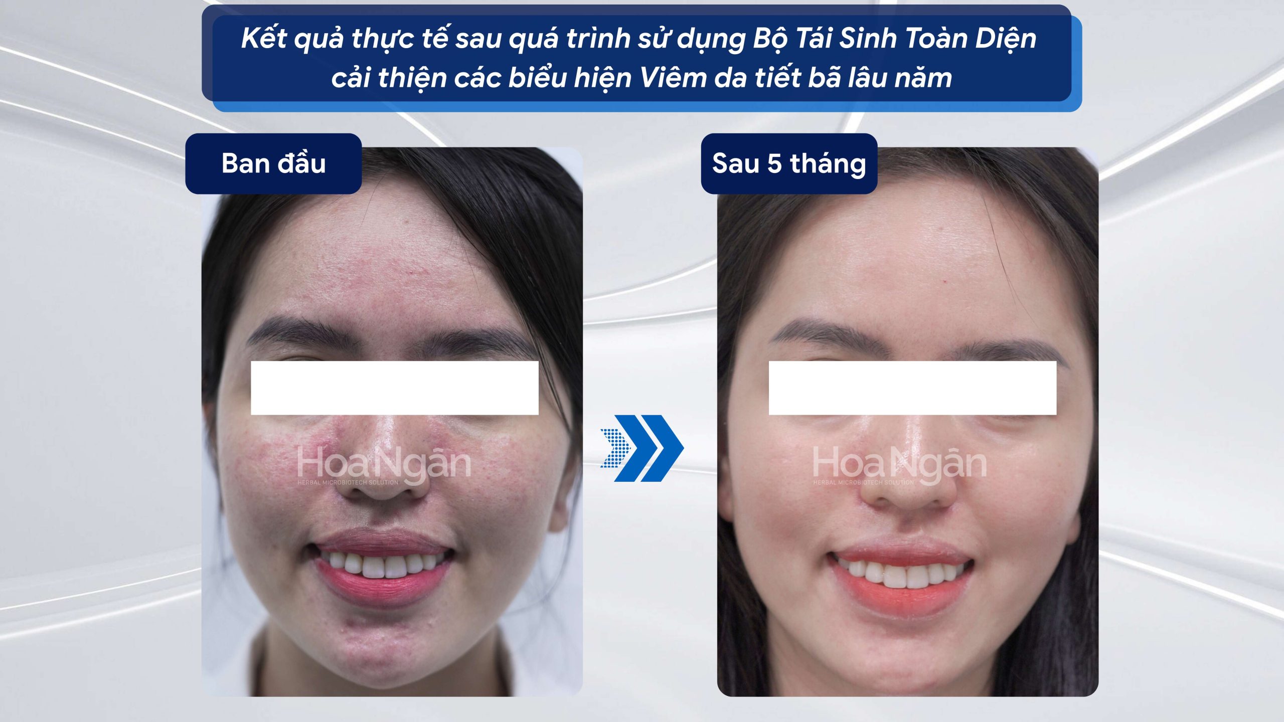 COMBO 3:
CHĂM SÓC DA TOÀN DIỆN 8