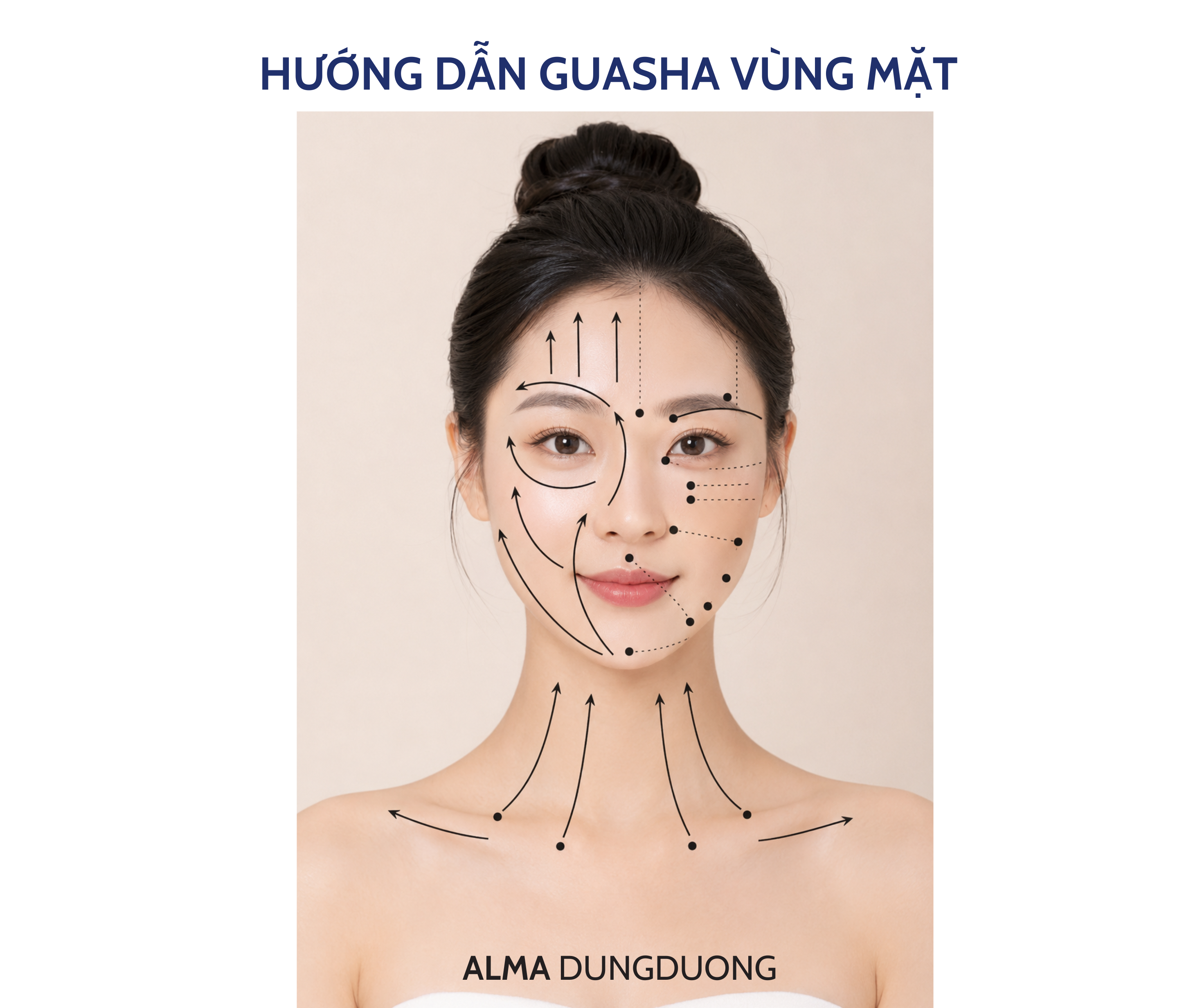 Guasha 1