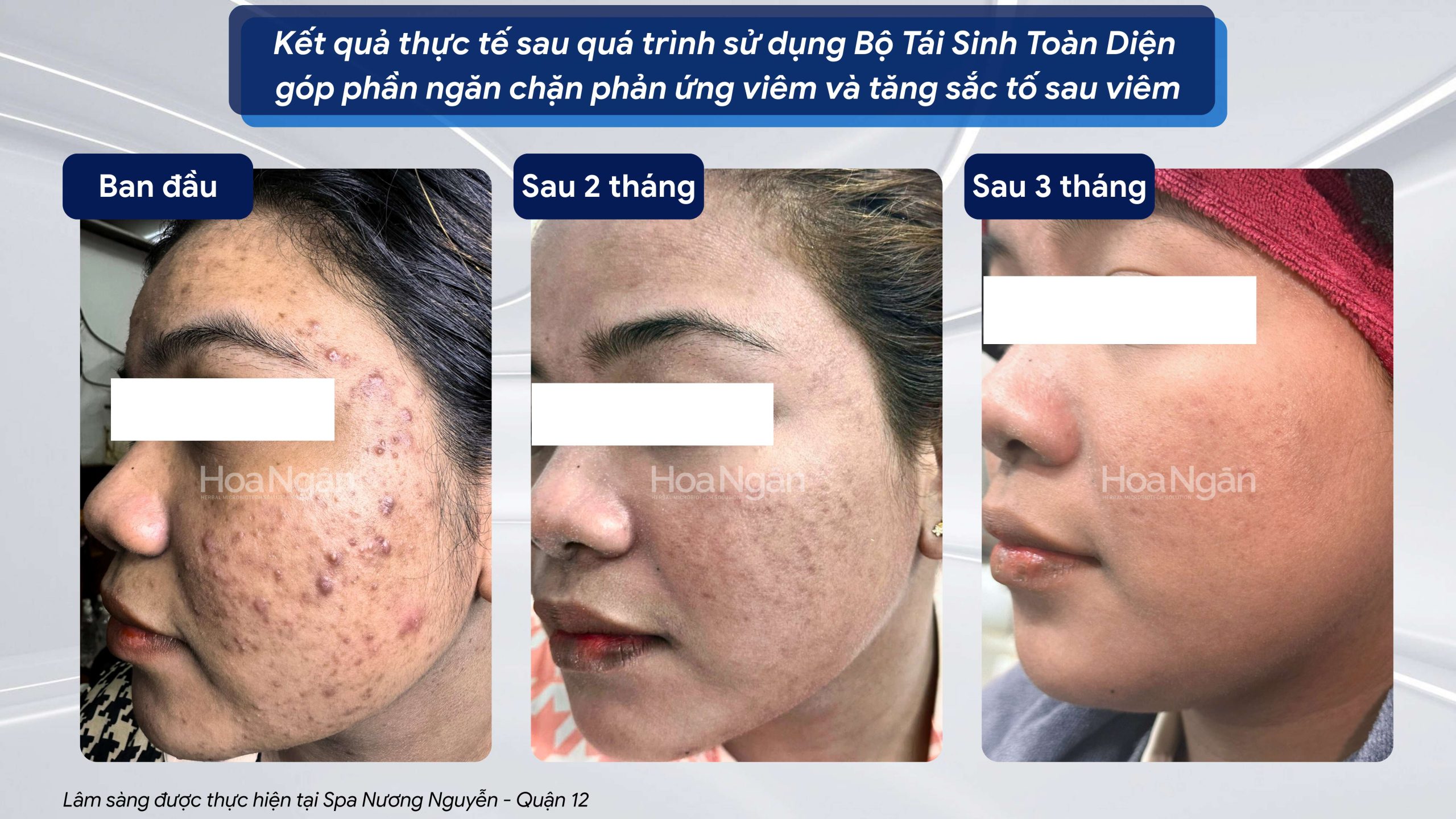 TINH CHẤT TÁI SINH VI SINH 2.0 5