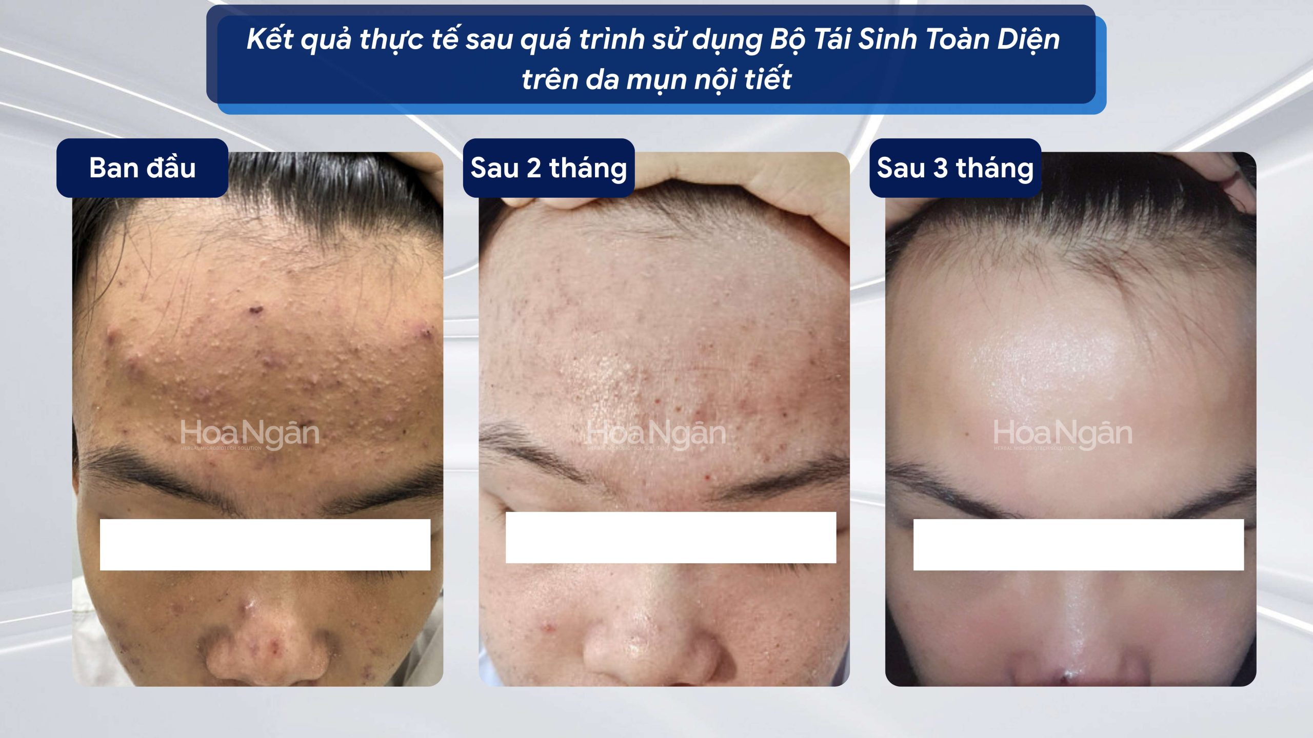 TINH CHẤT TÁI SINH VI SINH 2.0 6