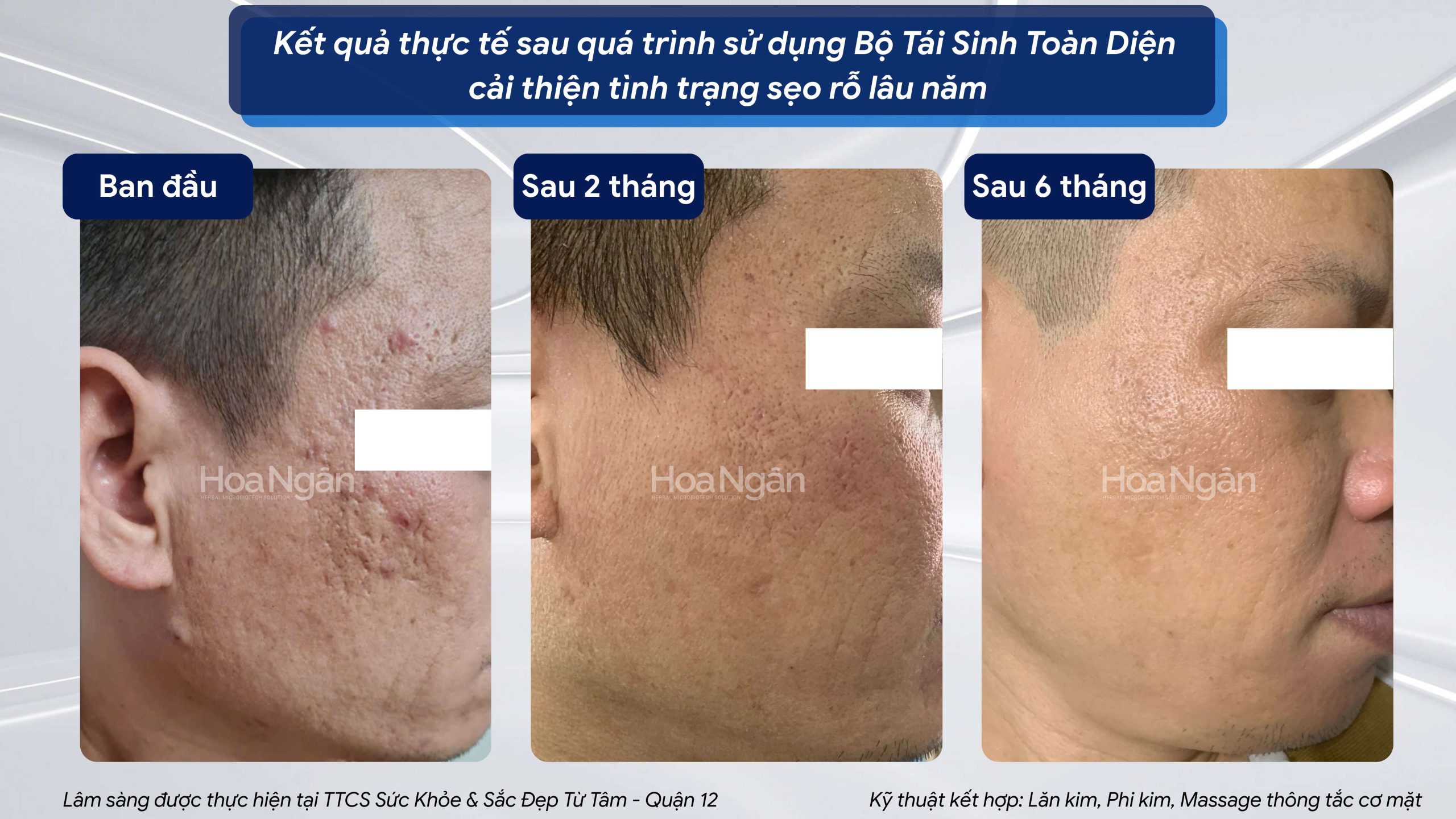 TINH CHẤT TÁI SINH VI SINH 2.7 4