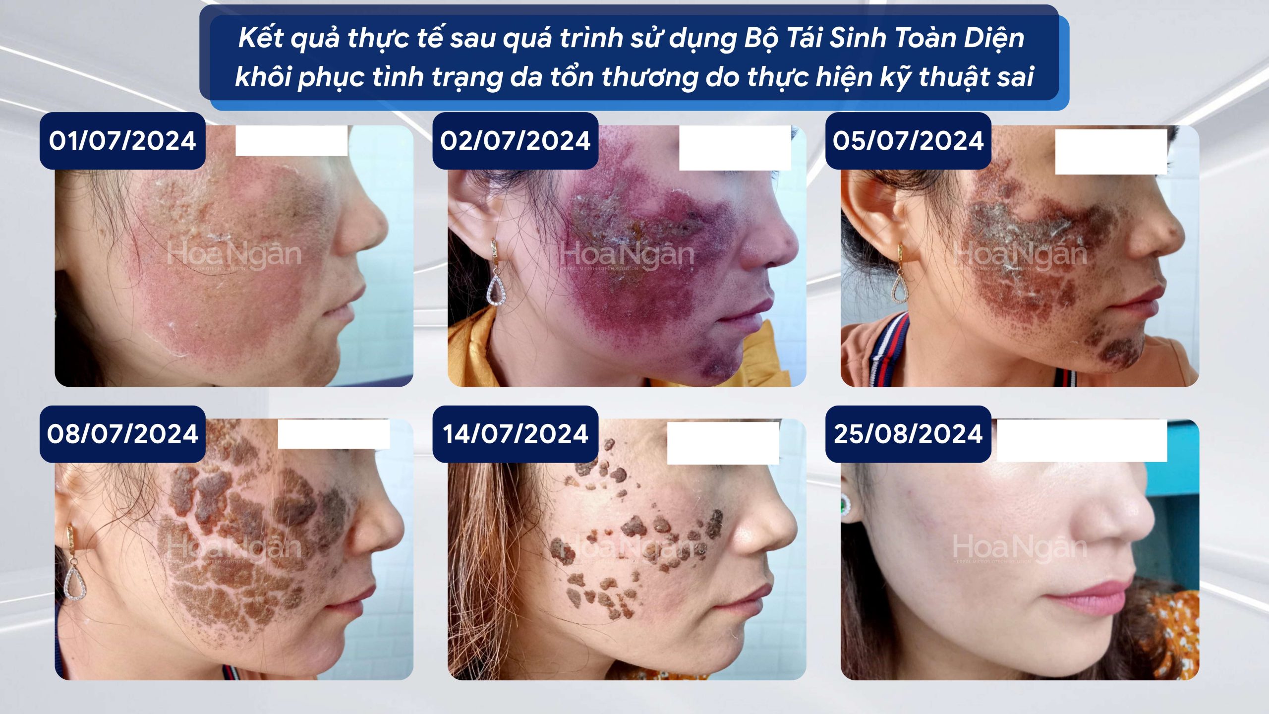 TINH CHẤT TÁI SINH VI SINH 2.7 6
