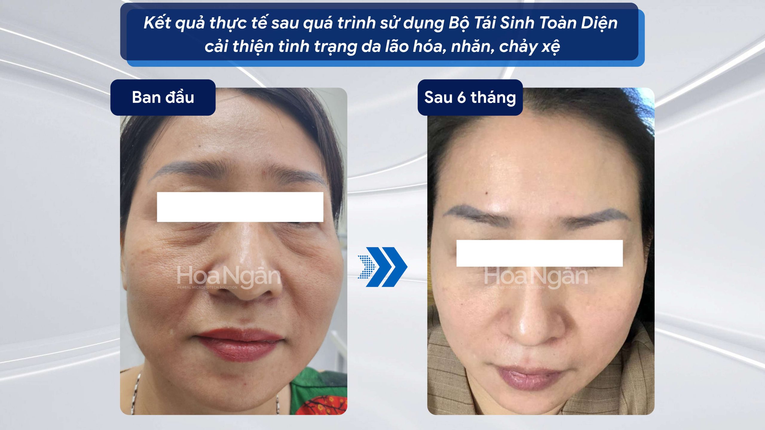 TINH CHẤT TÁI SINH VI SINH 2.7 7