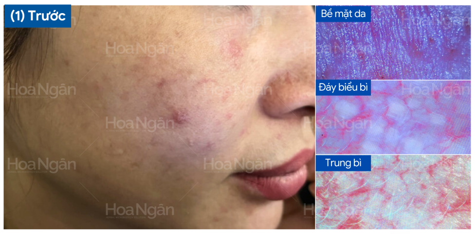 Chị Hà Anh — ảnh 1