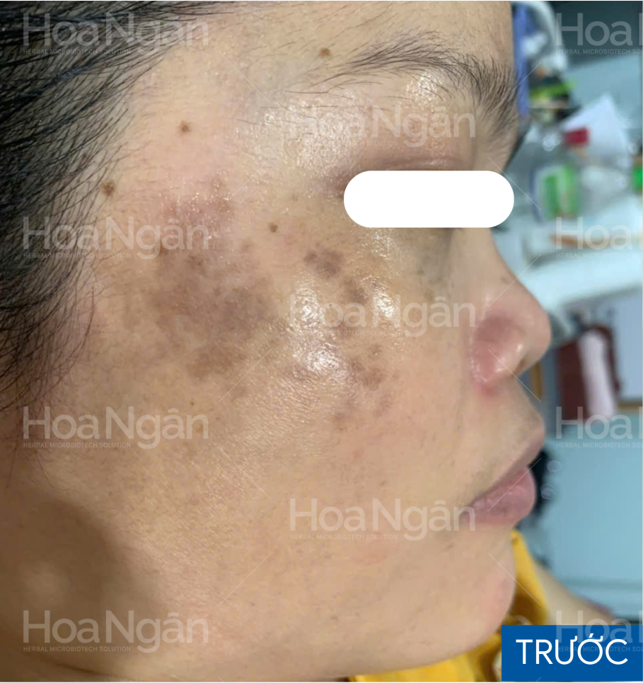 Khách hàng nữ — ảnh 1