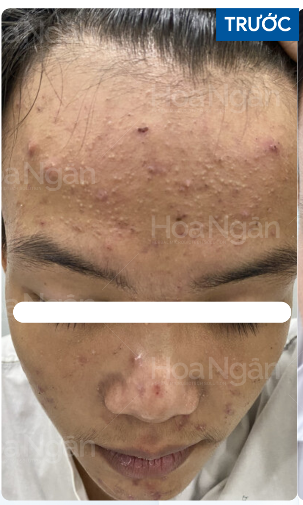 Khách hàng nam — ảnh 1