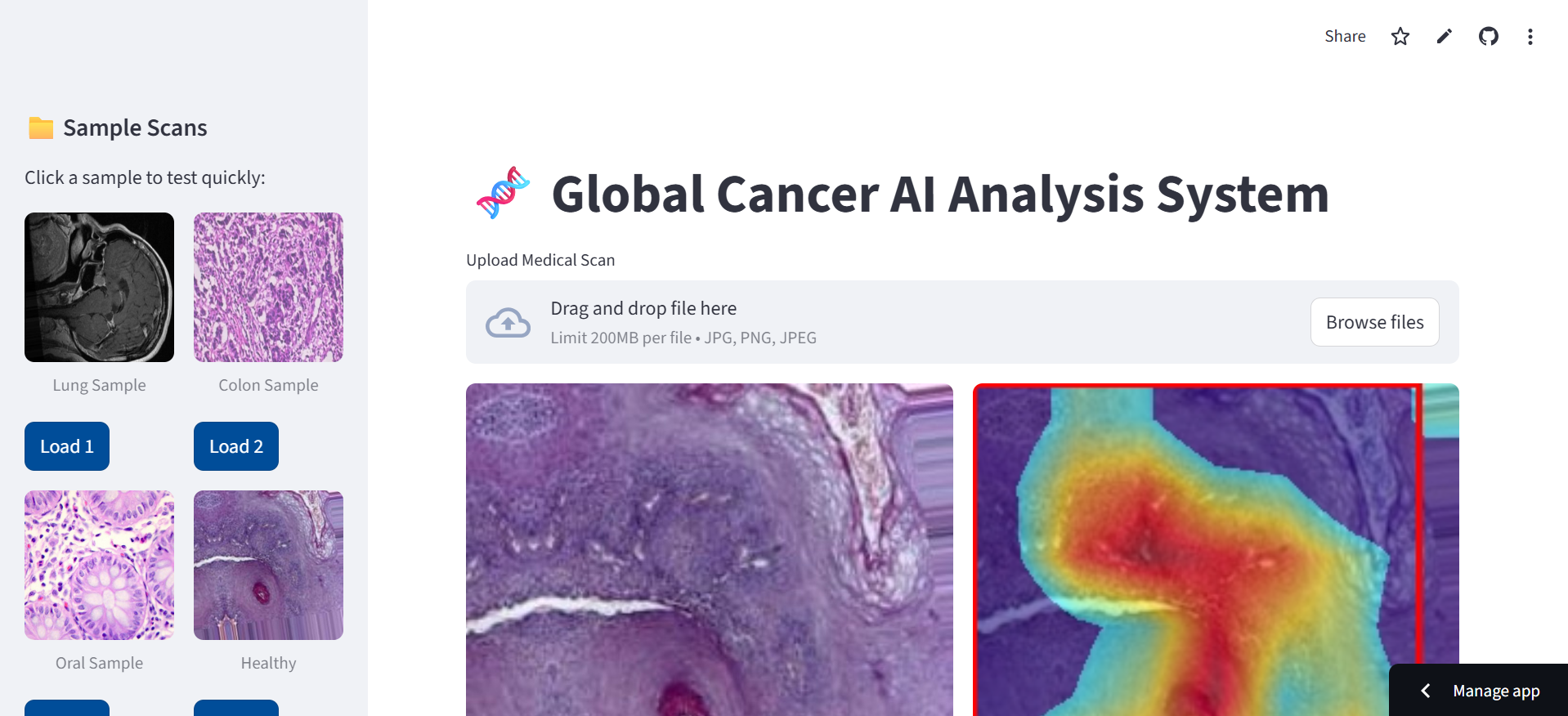 Cancer AI Analysis System