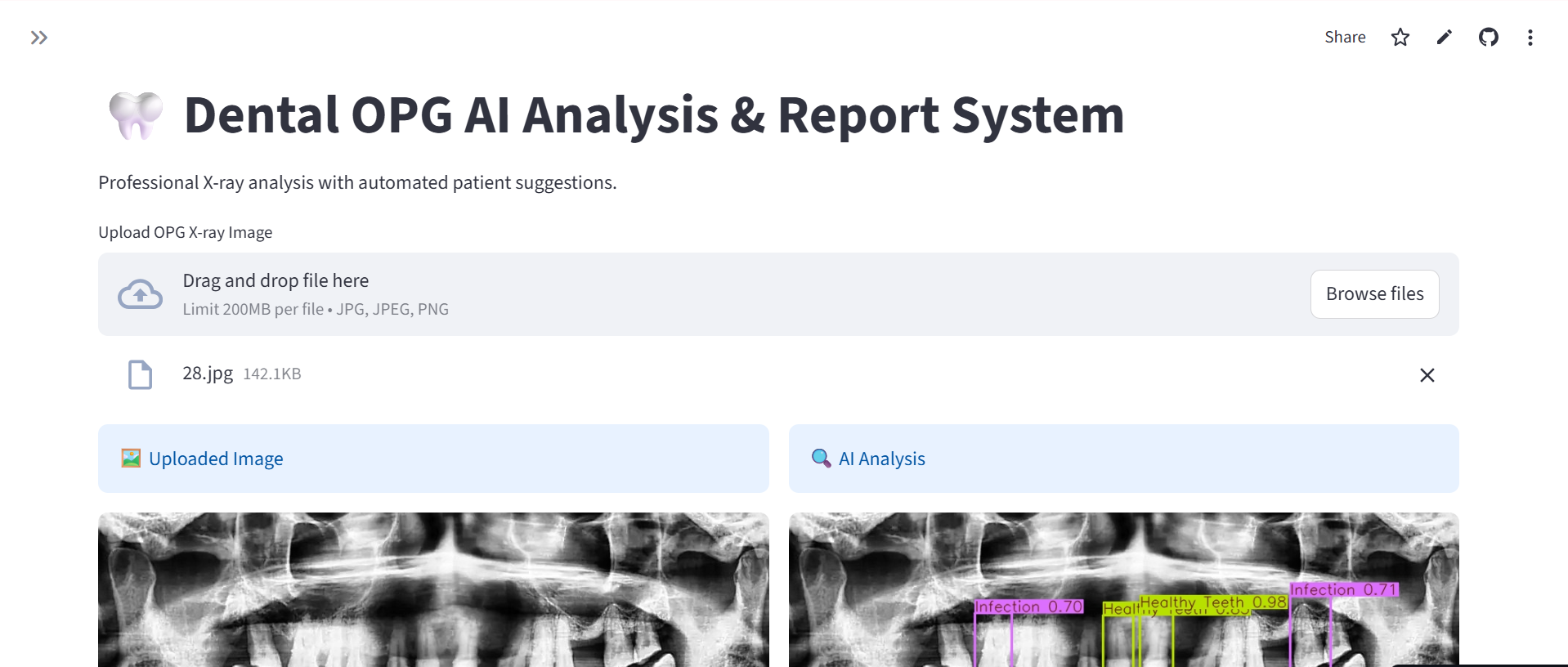 Dental AI Diagnostic System