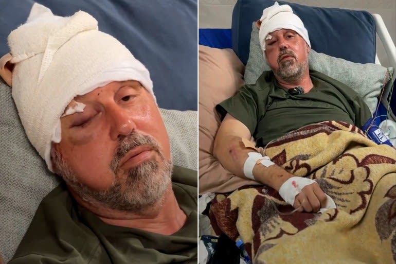 200 points de suture à la tête… Des colons agressent un Palestinien-Américain en Cisjordanie