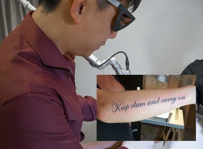 Singaporean Doctor Has Removed More Than 2 000 Tattoos Addresses Common Regrets And More In Q A