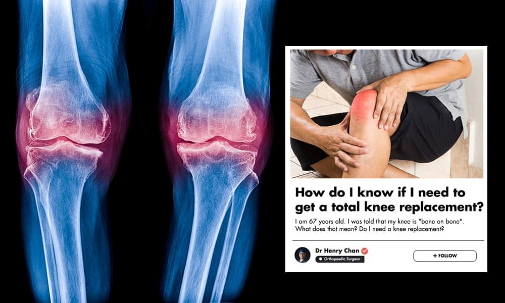 knee-pain-problem