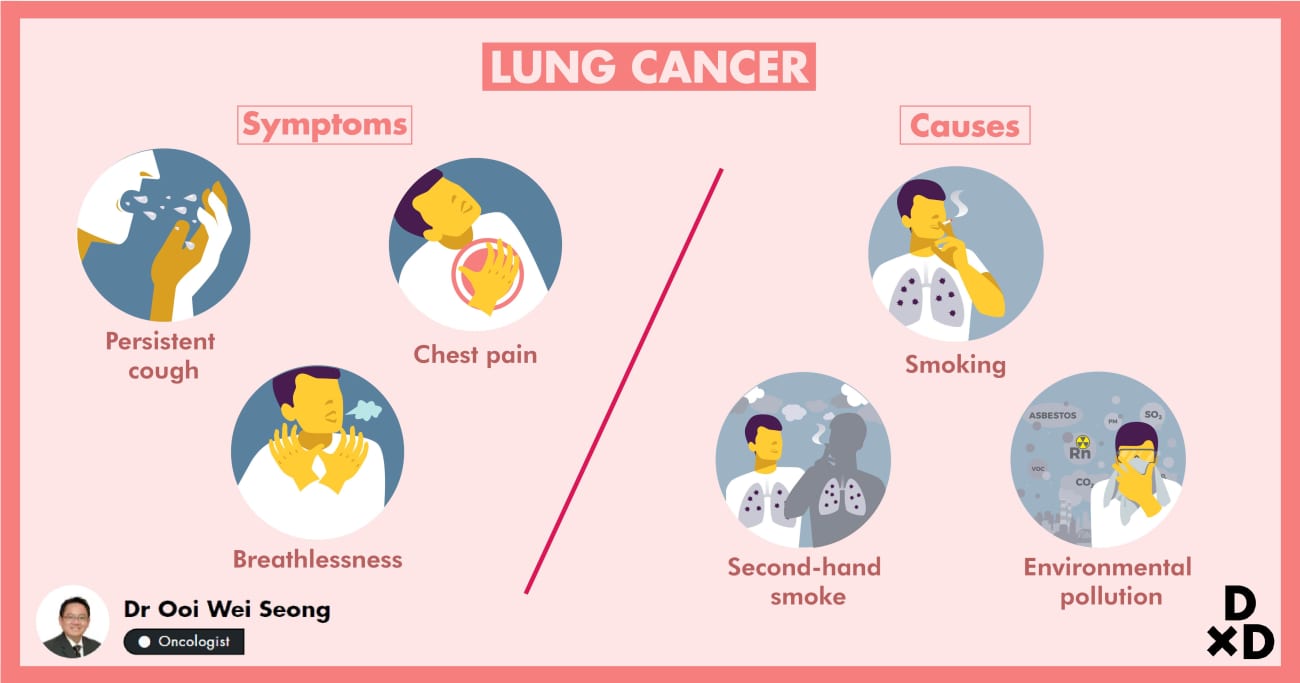 The Ultimate Guide to Lung Cancer Treatment in Singapore (2020)