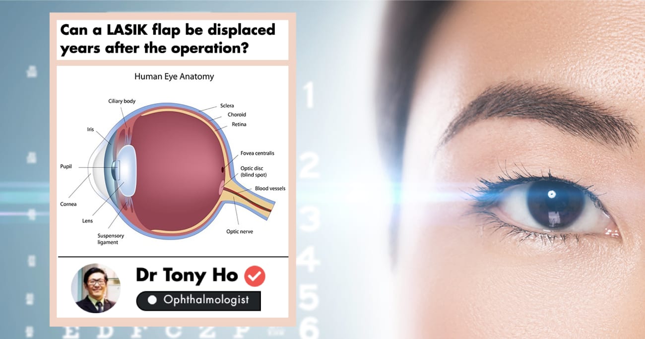 An Ophthalmologist Explains The Post Procedure Of A Lasik Surgery