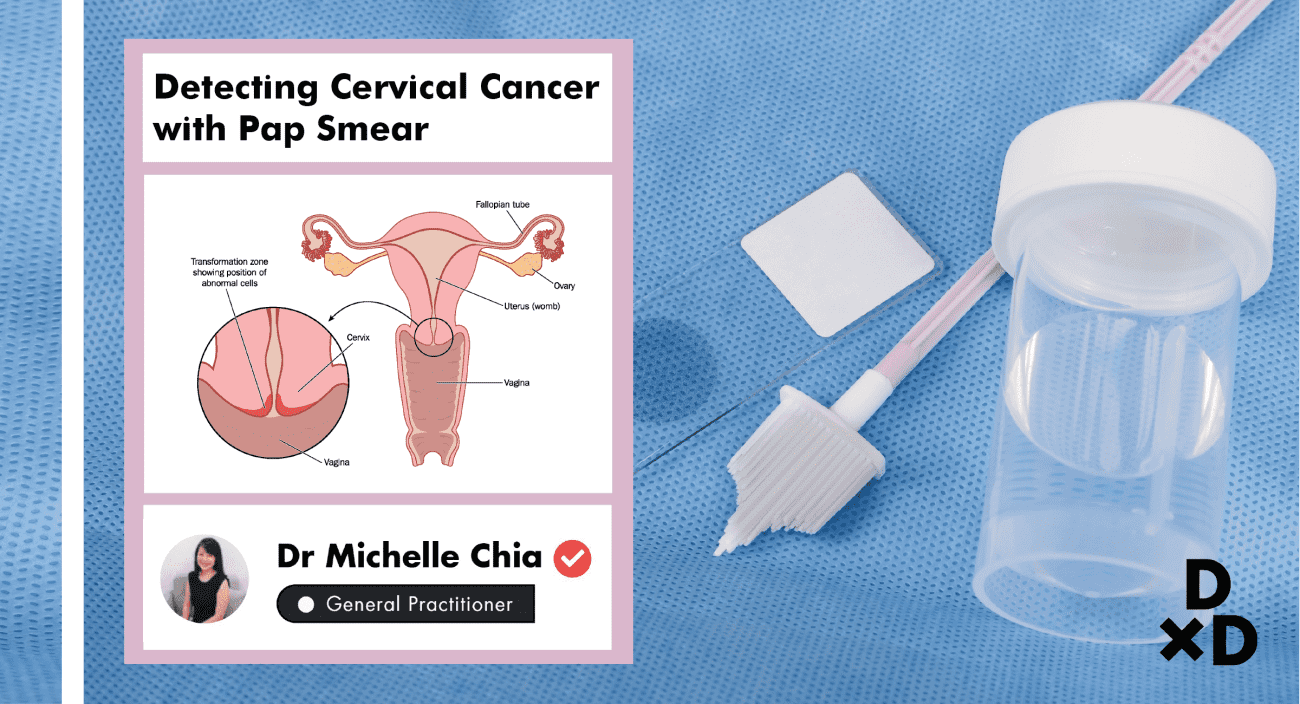 Getting A Pap Smear In Singapore The Ultimate Guide To Detecting Cervical Cancer