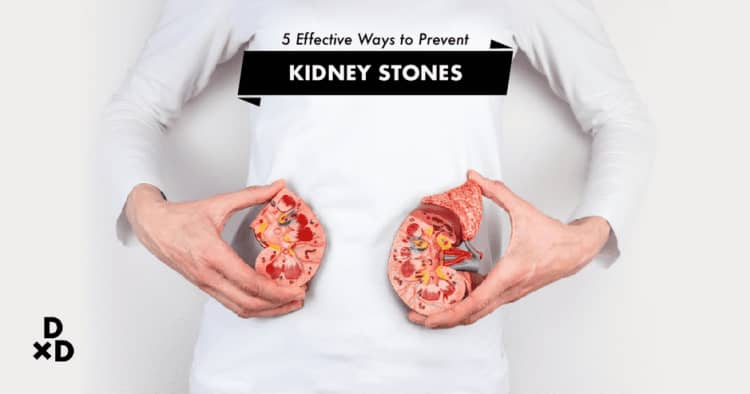 5 Effective Ways To Prevent Kidney Stones