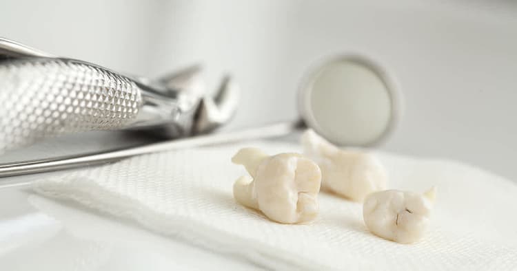 Your Wisdom Tooth Removal Concerns Addressed: Tips From A Dentist