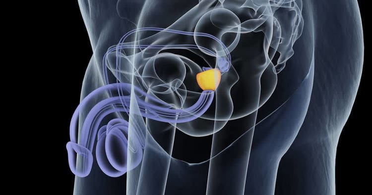 Managing Benign Prostate Hyperplasia & Peyronie’s Disease: A Urologist Discusses