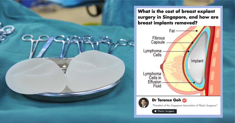 The Ultimate Guide to Textured Breast Implants for Lymphoma (BIA-ALCL) in Singapore (2021)