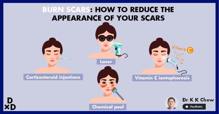 Too Hot to Handle: 5 Ways You Can Get Burn Scars Treated