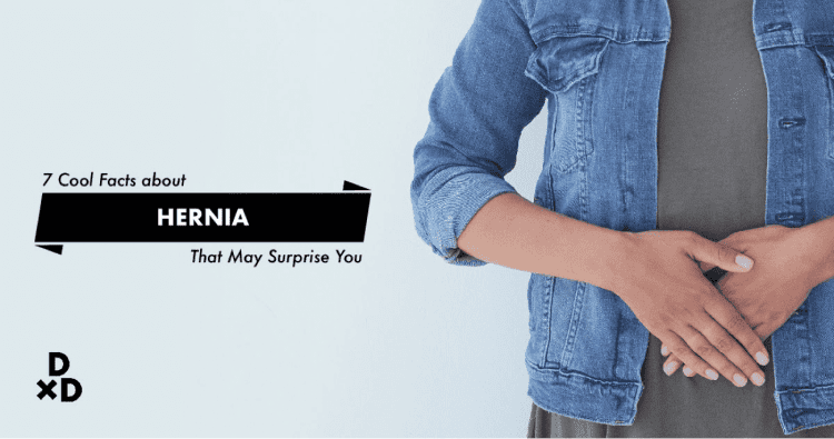 7 Surprising Facts About Hernia That May Surprise You