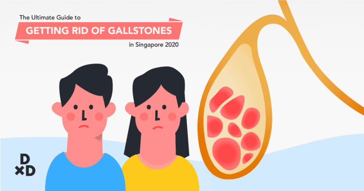 The Ultimate Guide to Getting Rid of Gallstones in Singapore (2021)