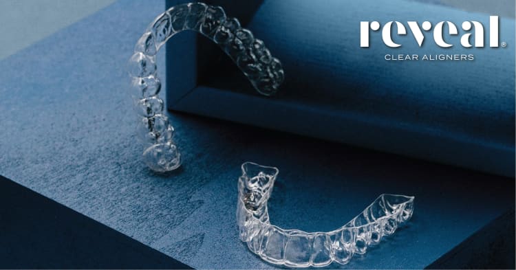 Reveal Clear Aligners: The Next-Generation Aligner System in Singapore (2021)