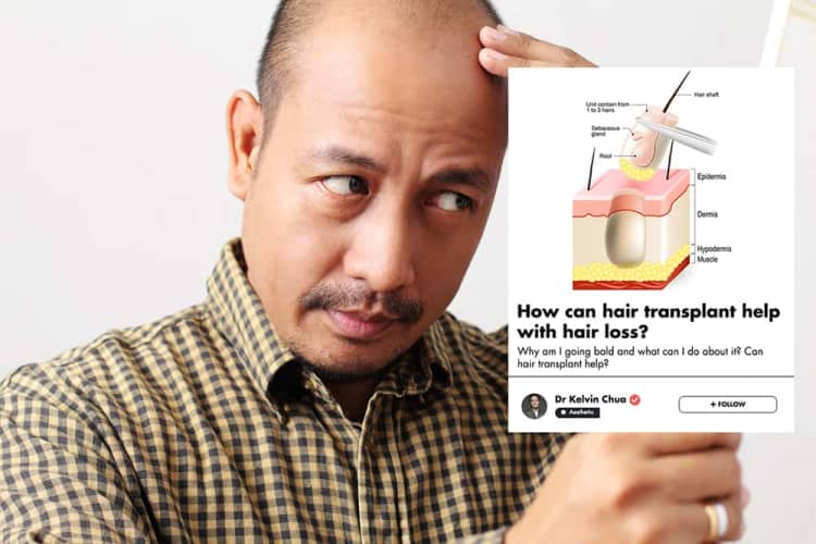 Frustrated With Hair Loss? This Singaporean Doctor Explains How A Hair Transplant Might Help