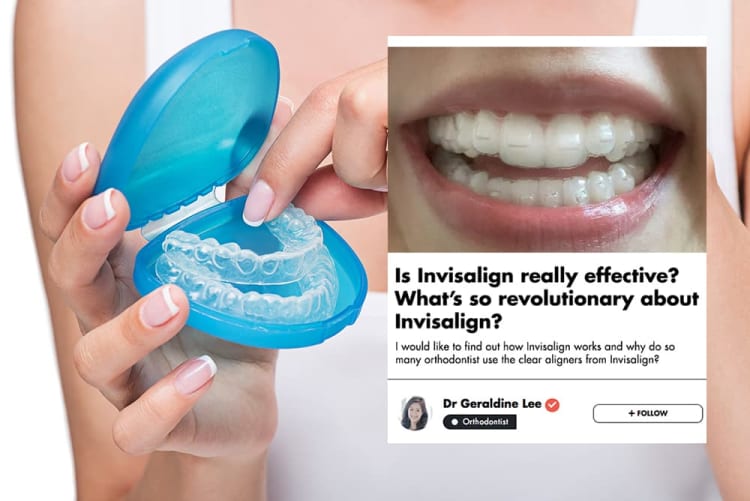 This Singaporean Orthodontist Shares The Most Important Things You Should Know About Invisalign 