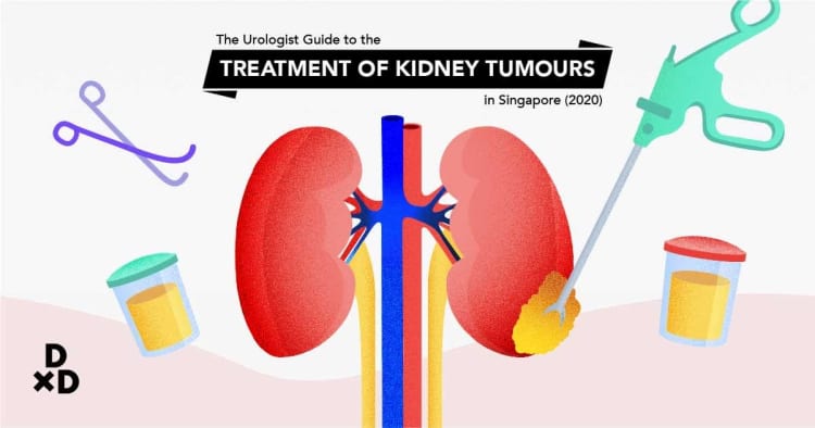 The Ultimate Guide to the Treatment of Kidney Tumours in Singapore (2021)