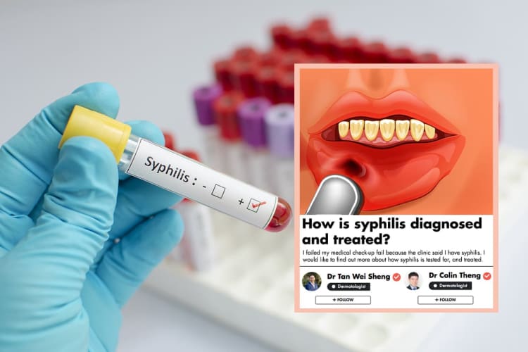 How Is Syphilis Diagnosed And Treated? Singapore Doctors Explain