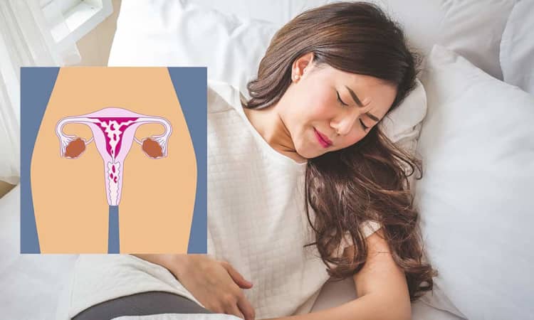 Is That Time Of The Month Late Again? An Irregular Menstrual Cycle Could Point To Womb Cancer, Says This Veteran Gynaecologist