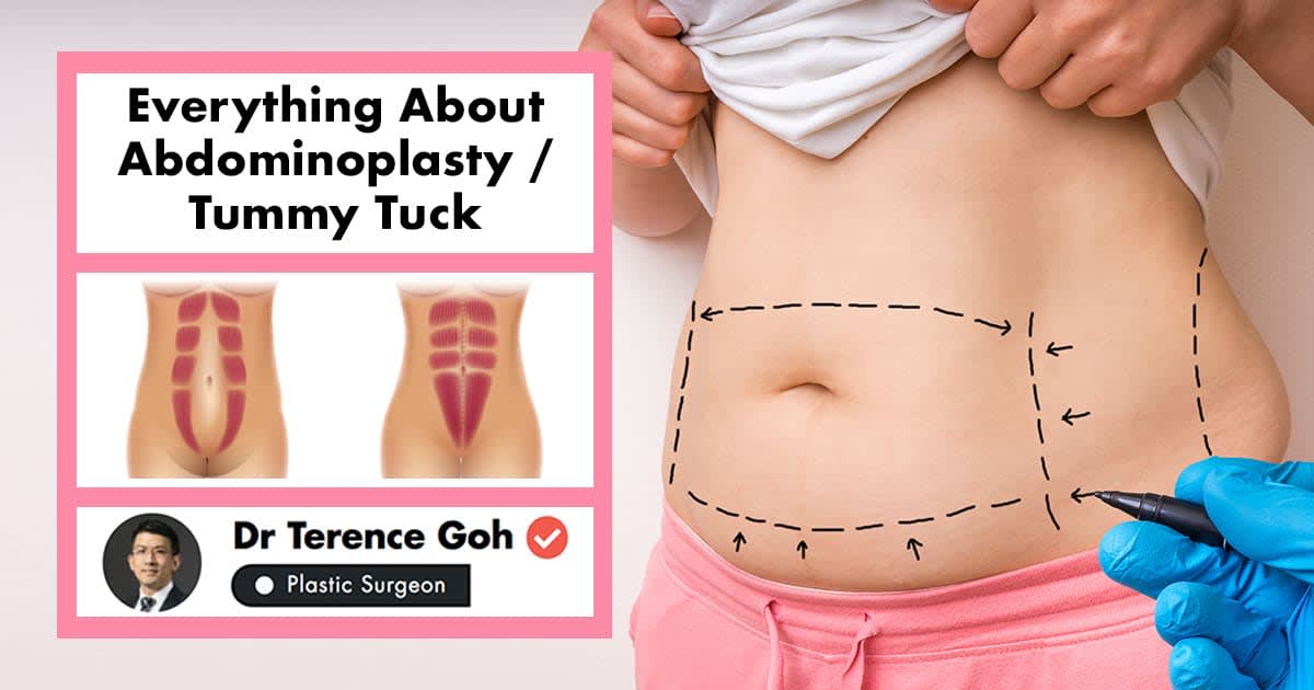 Tummy Tuck Your Guide To Getting An Abdominoplasty In Singapore Human