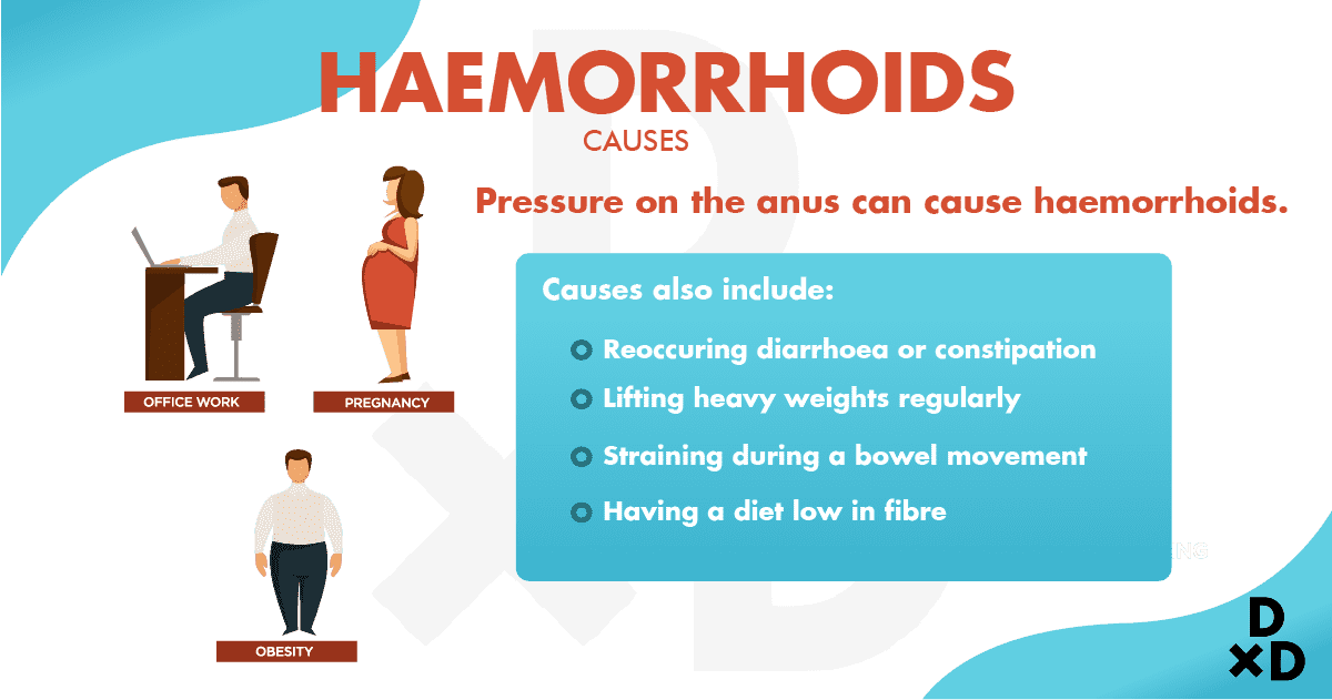 Haemorrhoids: How You Can Prevent that Pain in the Butt