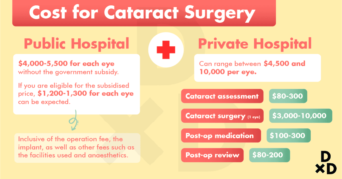 A Comprehensive Guide to Cataract Surgery in Singapore by