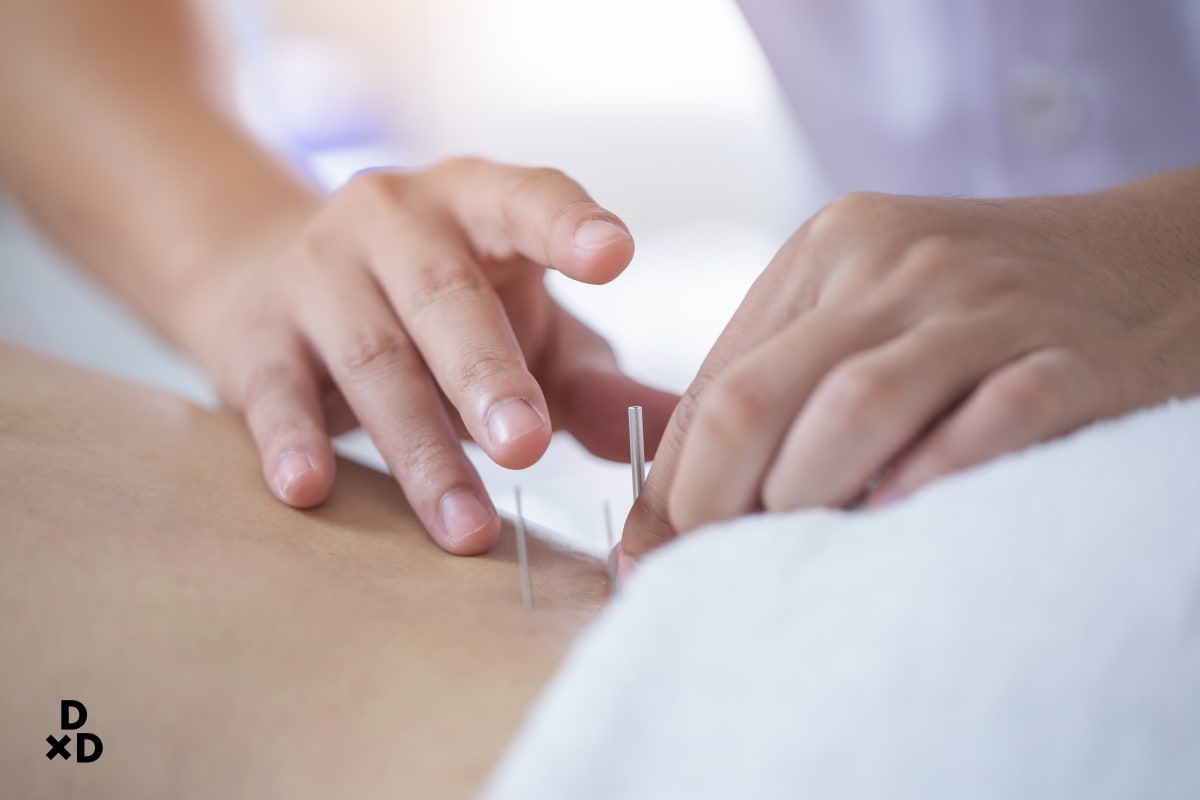 acupuncture for period cramps