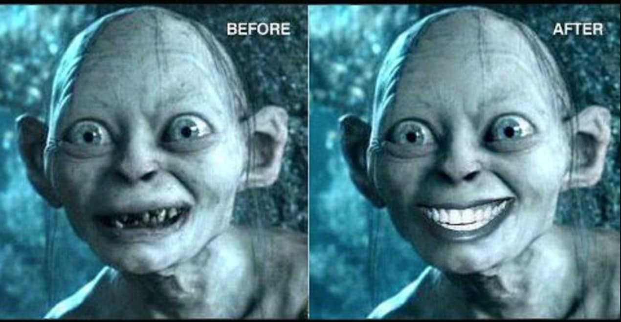 Post-Teeth Whitening Home Care (Or How To Maintain Your New Megawatt Smile!) undefined