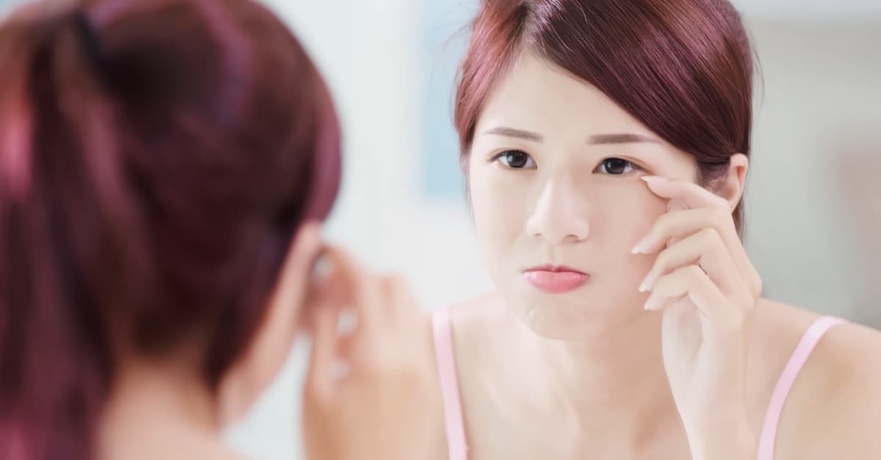 The Complete Guide To Dark Eye Circle Treatments In Singapore (2018) undefined