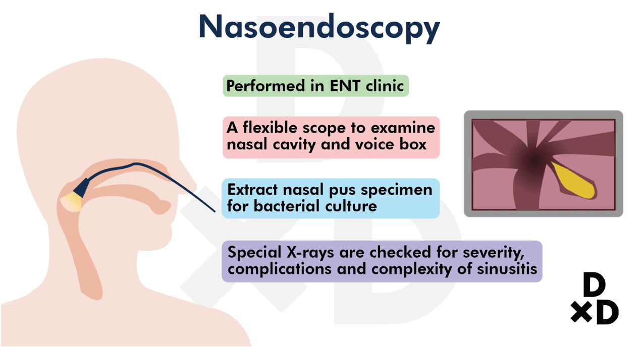 nasoendoscopy