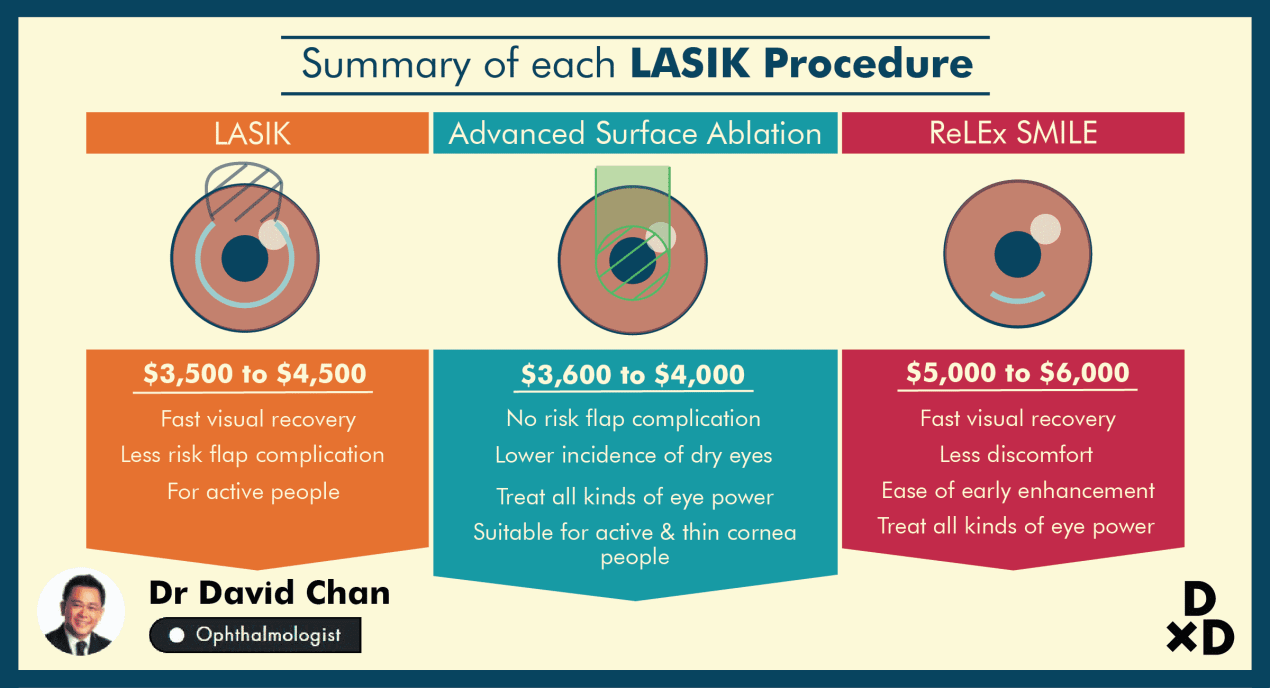 The Complete Guide To Lasik In Singapore 2020