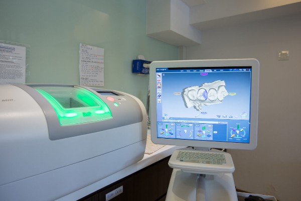 gentle dental group review - cadcam