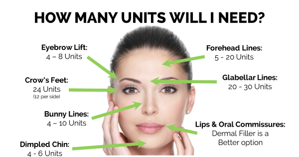 botox units singapore