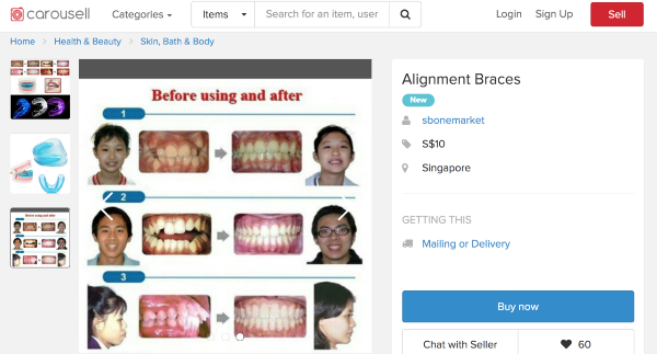 Orthodontist braces Singapore